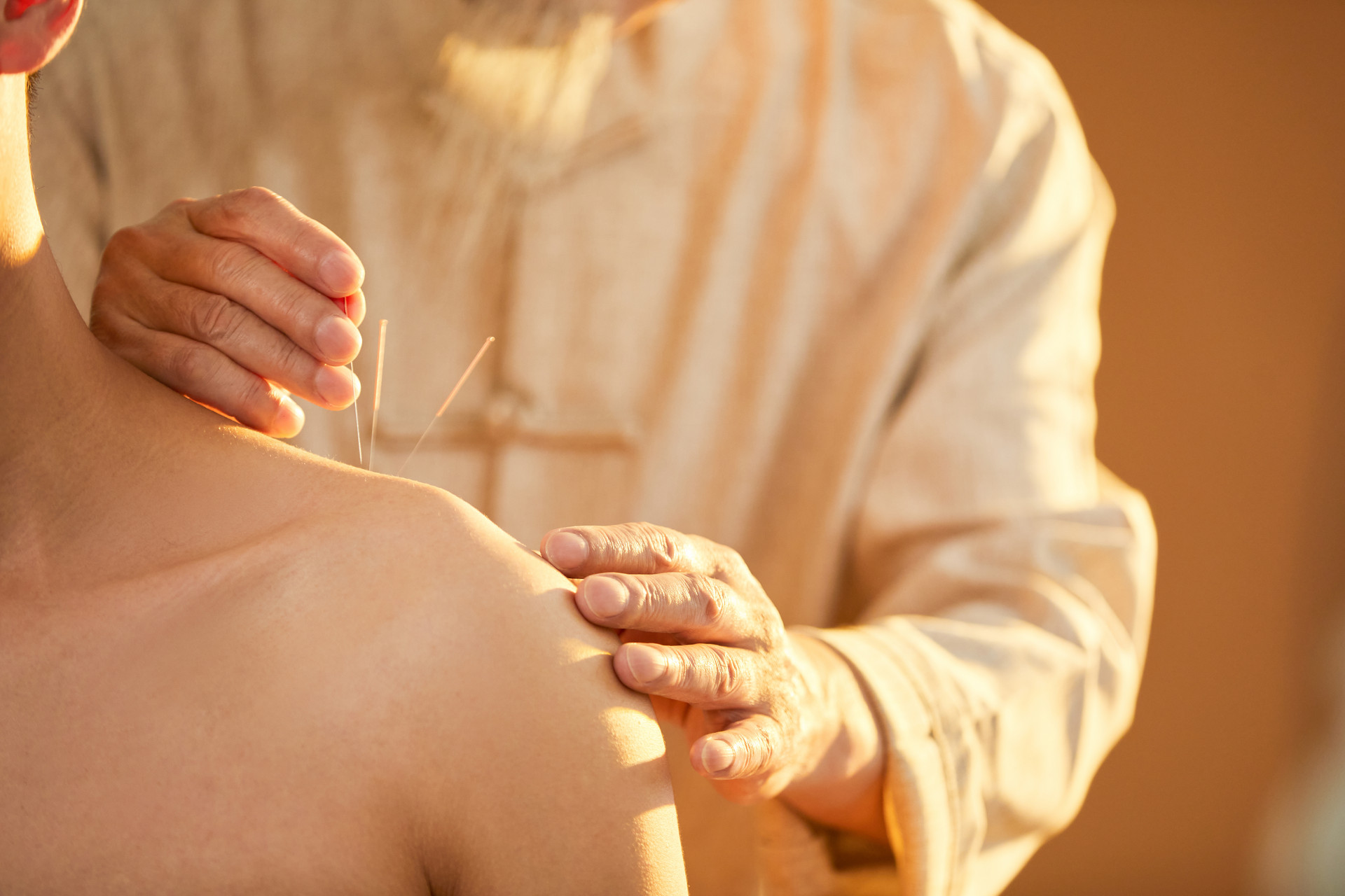 Deep Needle Acupuncture: A Powerful Approach to Treating Mental Disorders